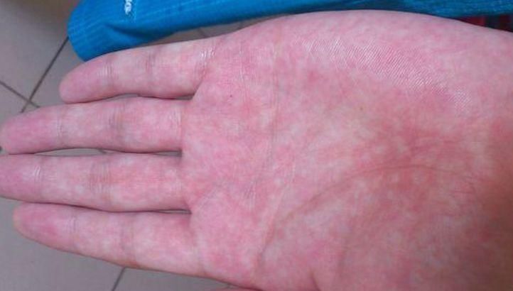 手掌|无论男女,如果手上没有这3个“特征”,恭喜你,肝脏还很健康