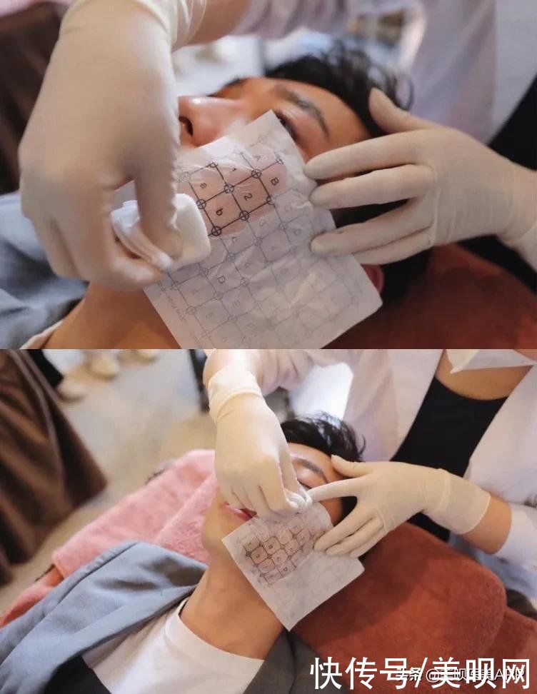 爱豆们竞当医美达人？男性适合的轻医美项目top5合集