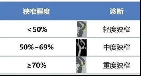 颈动脉|近2亿人有颈动脉斑块，60岁以上几乎全有，2个方法让它“消失”