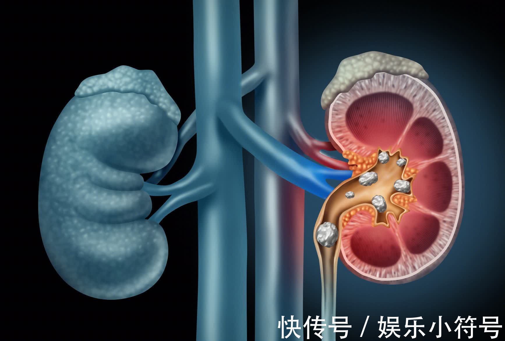 疾病|有2种病外号不死的癌症,医生:没有特效药,没办法根治