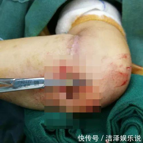 医生|4岁女孩得怪病,医生检查后,忍不住训斥父母心真大