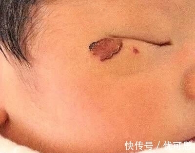 产科医生|女子发现宝宝脸有镰刀痕,去医院医生告知不是病,看完监控报了警