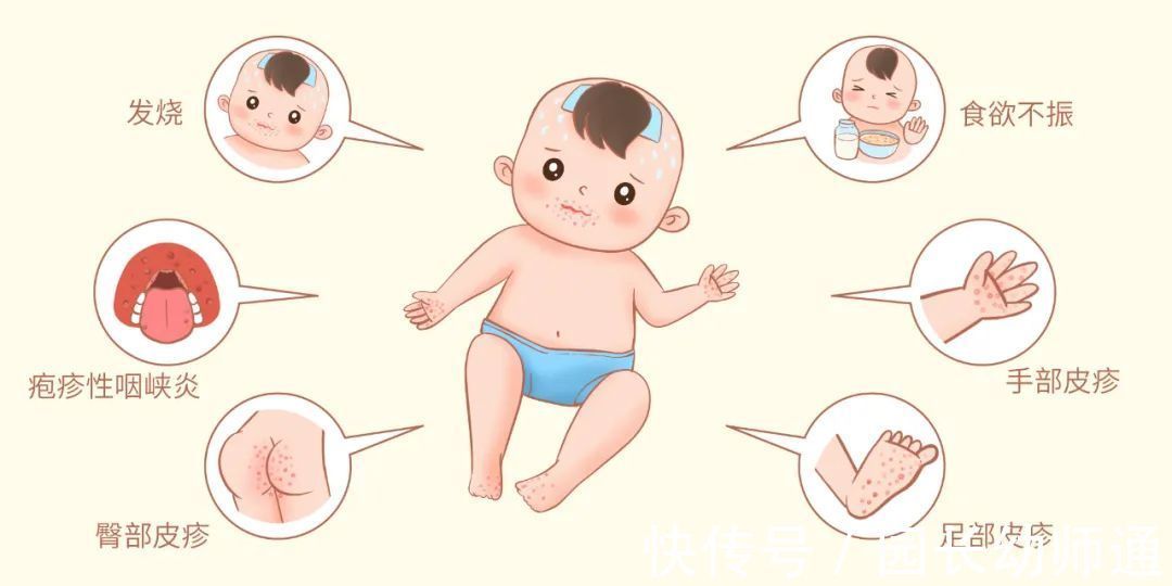 保健|幼儿园温馨提示:秋季幼儿传染病高发,预防保健小贴士转给家长!