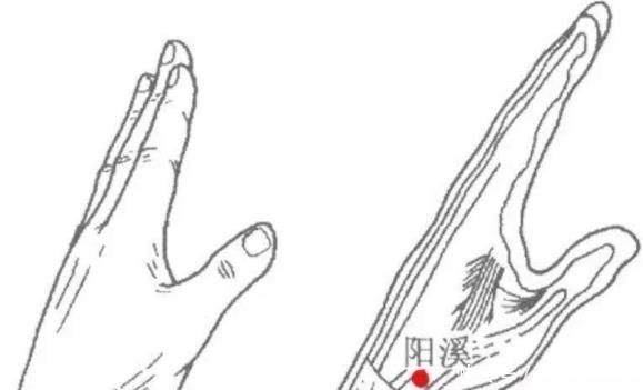 耳鳴|手腕有個“坑”，耳鳴見它就跑春季常用