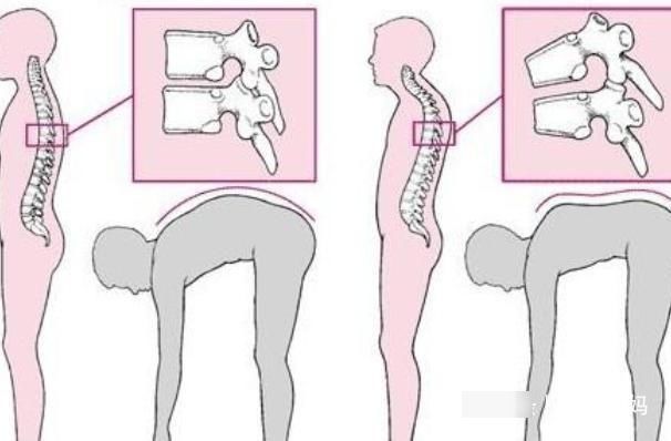会造成|孩子错误的坐姿竟然会影响身高看完这几点，家长是不是很后悔