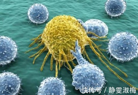 恶性肿瘤|2种恶性肿瘤很会伪装，一旦发现可能就是晚期！最好提前预防