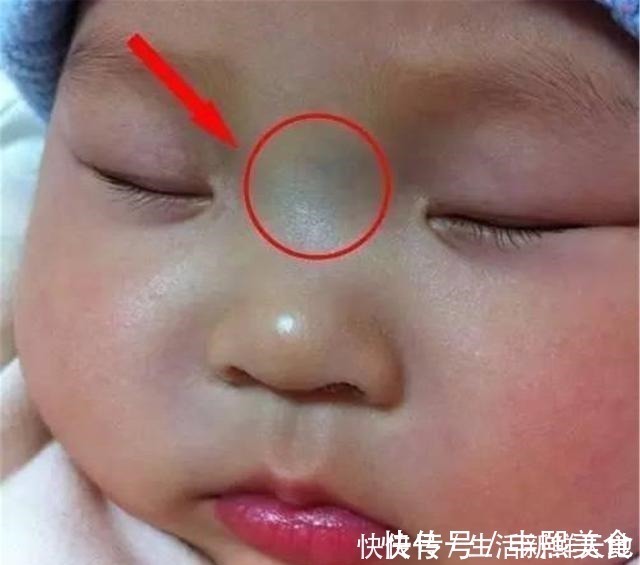 困难型|宝宝鼻梁上有“青筋”,体质差脾气也大别因误会忽略真正的诱因!