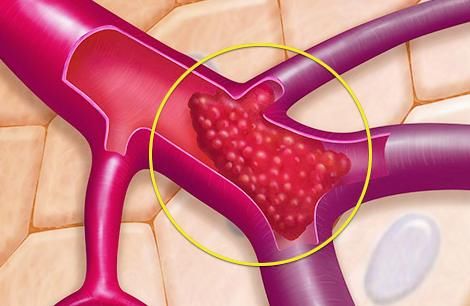 越来越|人老了,感觉腿越来越无力,有没有办法对抗呢?有!医生告诉您!