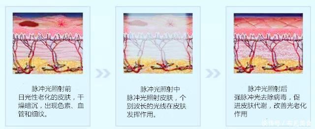 这些医美项目比你们所有的化妆品还有用！