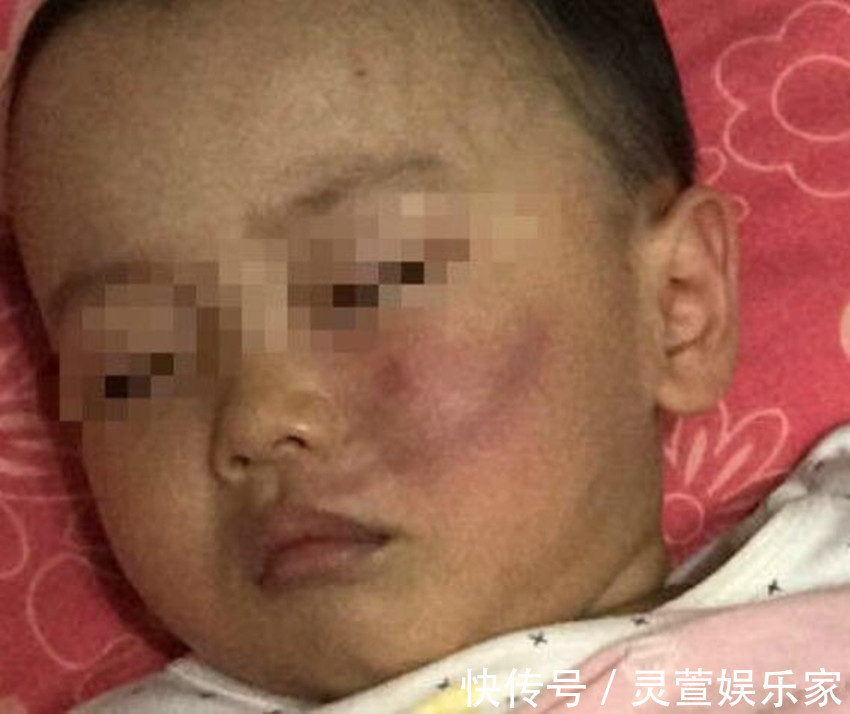 琪琪|两岁男童从购物车被甩出,哭了几声照样玩,第二天却意外离开人世