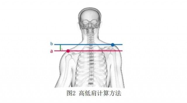 干预|八成青少年儿童存在不良姿态问题！怎么办？