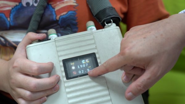 田光巍|男子胸怀“钢铁心”变身“背包客”登顶黄山，协和医院为终末期心衰患者植入“人工心脏”