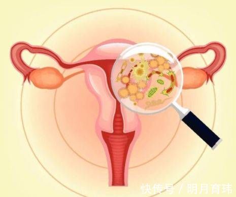 家属|29岁女子,查出宫颈癌晚期,家属病床前痛哭,无奈放弃治疗!