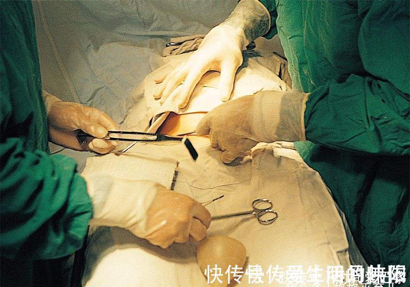 肚子|剖腹产只是“挨一刀”吗?术后恢复期有哪些要注意的?