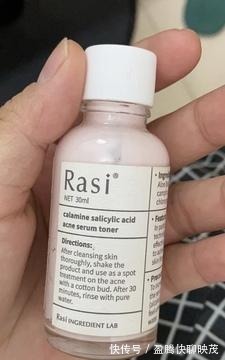 痘痘|天气越热、“痘痘”越多?3个原因+改善方法,瑕疵痘痘肌有救了