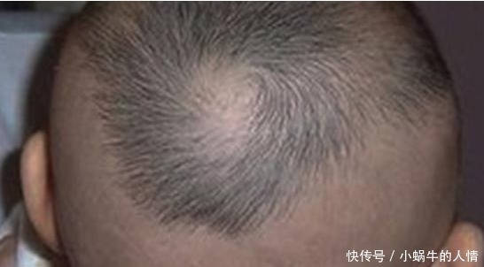 老年人|给孩子剃光满月头,到底是对还是错,儿科医生的一句话怒斥家长