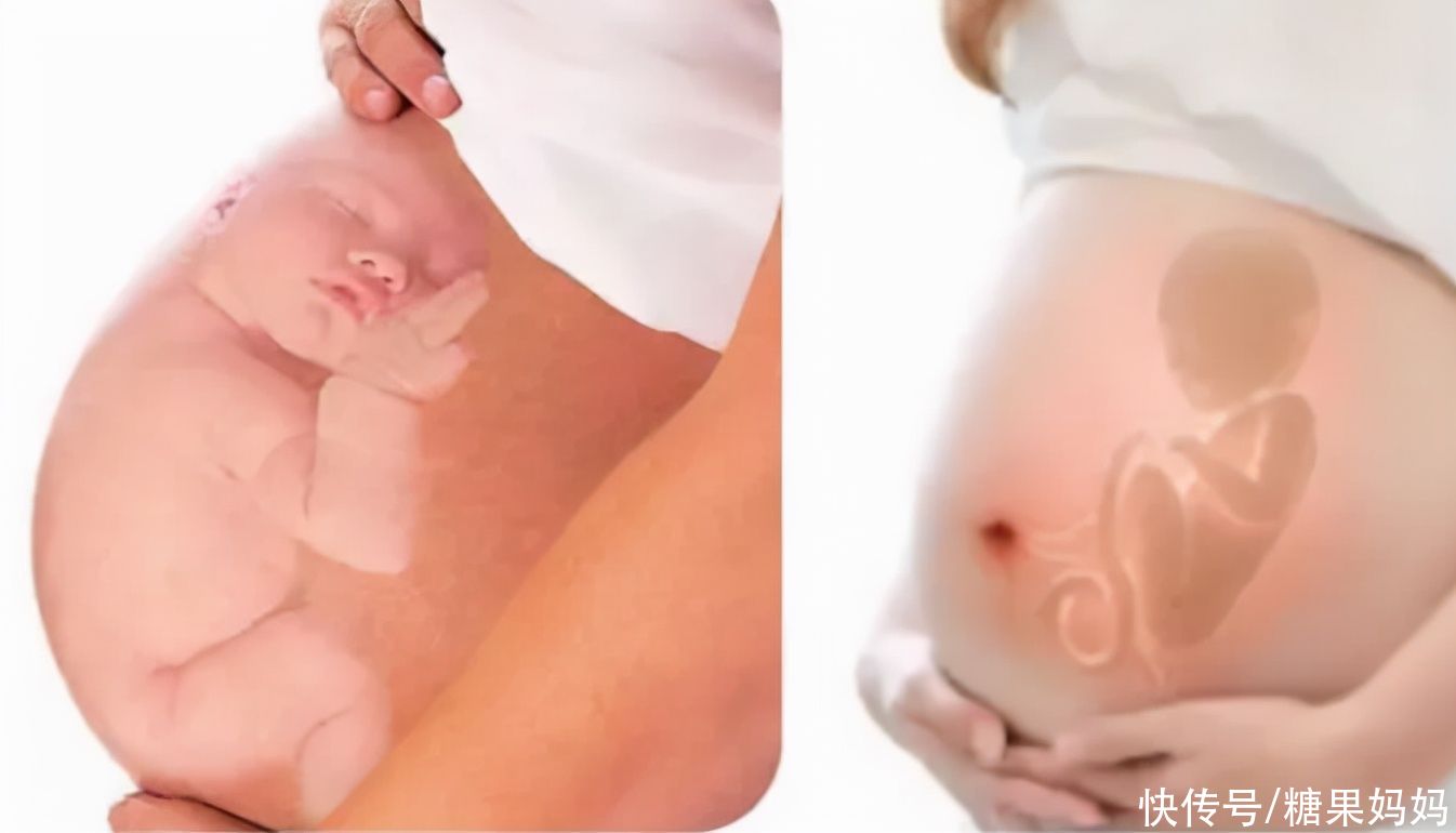 吴女士|孕肚只有右侧比较硬，是因为怀了女宝？准妈妈需了解真实原因