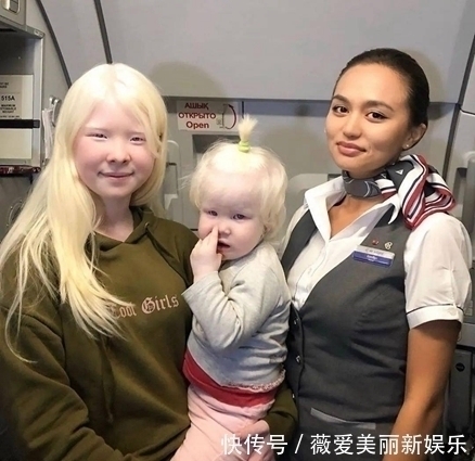 白化病|一对罕见的“月亮姐妹”,被人嘲讽14年,拍完一组照片后惊艳众人