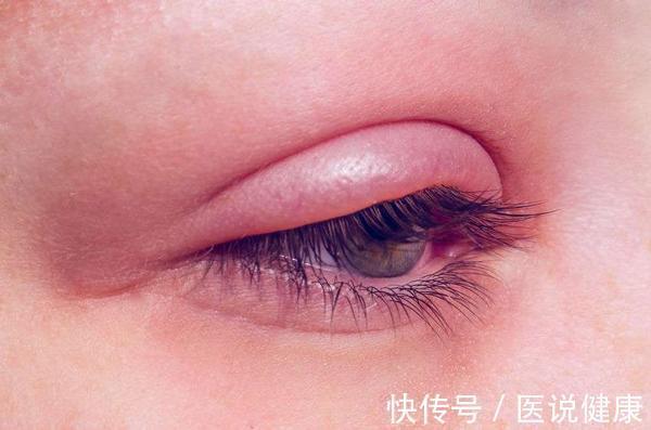 肾虚|女性也要防止肾虚问题,若发现这5种情况,或是肾虚的表现