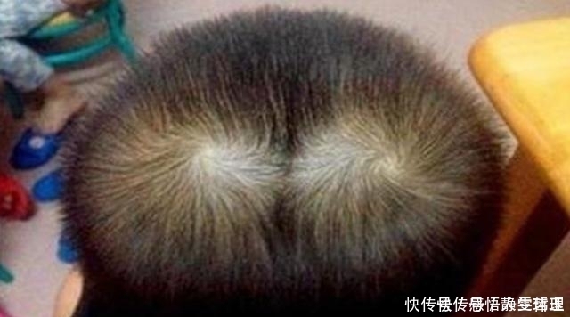 孩子头上的“旋”的个数,暗示孩子智商高低家长要了解真相