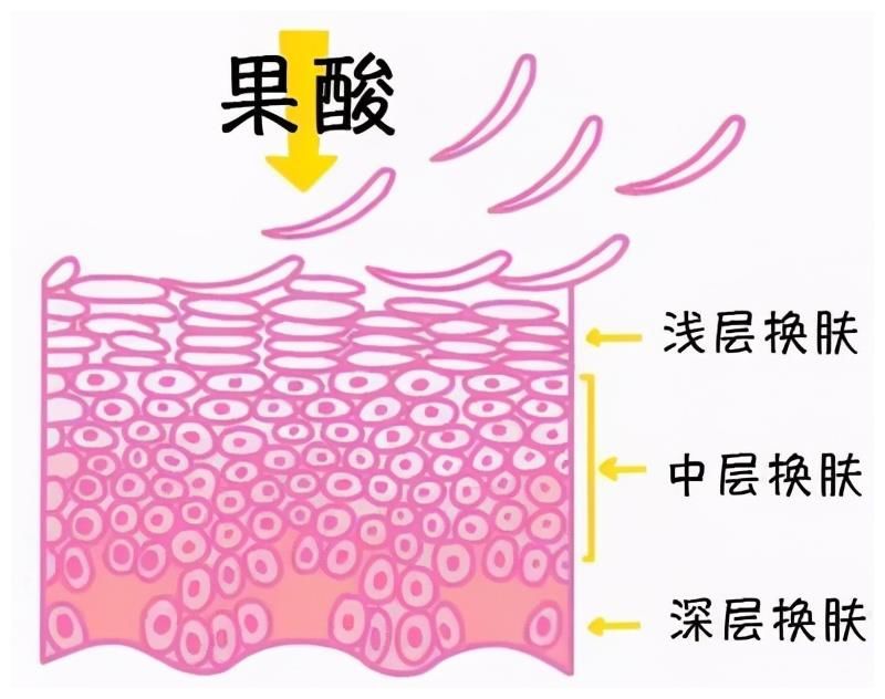 你真的懂刷酸吗？刷酸都有哪些好处？