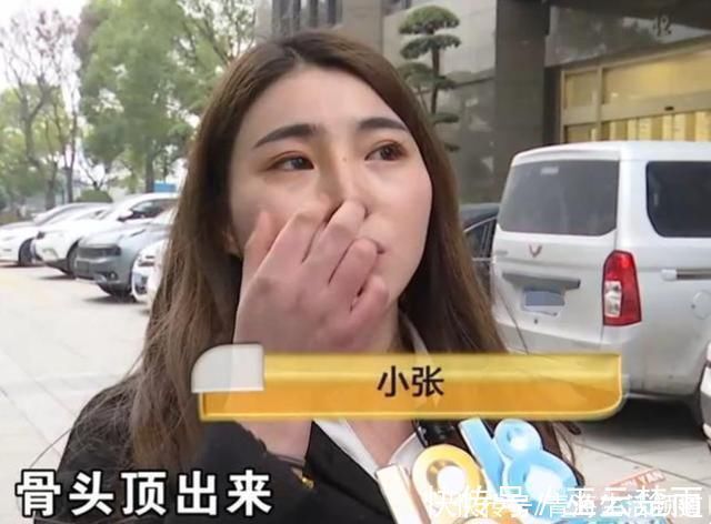 张女士 女子花38000隆鼻，术后像“老鹰鼻”，医院审美不同，我觉得好看