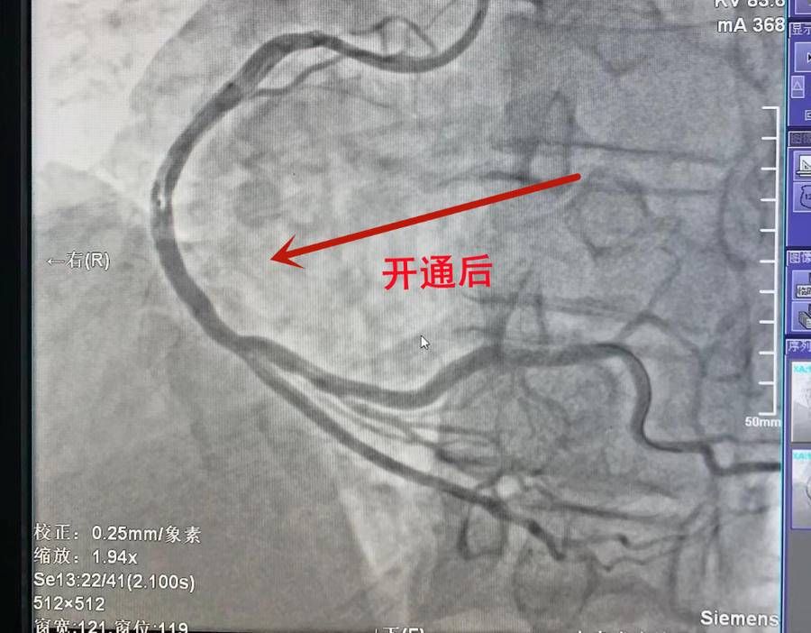 开通|宁津县人民医院：亲历抢救现场 感受惊魂一刻