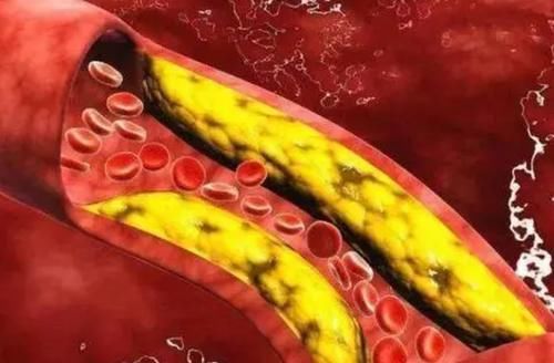 松花蛋|“高胆固醇”食物榜单公布,鸡蛋排最后,榜首很多人当成宝