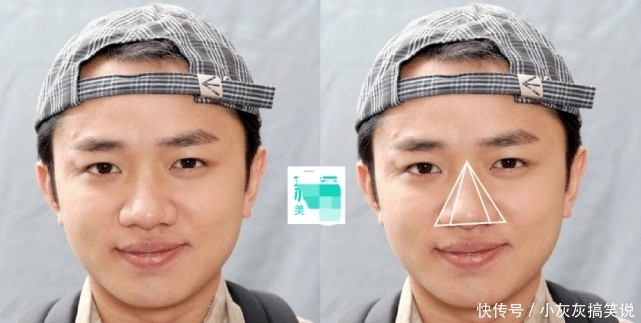 优越鼻型精细化到山根的宽窄?对颜值影响还真大