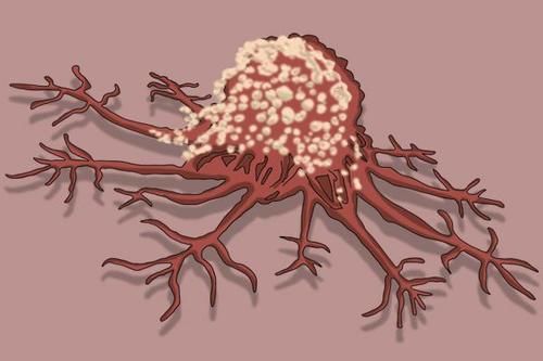 乳腺结节|女子长期坚持喝蒲公英水,后来身体怎样?蒲公英真能杀死癌细胞?