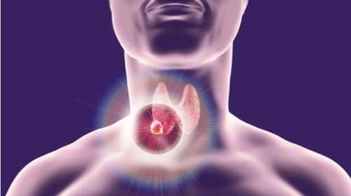 甲状腺肿大|患有甲状腺结节的人，起床时注意这3件事，或对消散结节有帮助