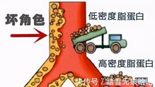 胆固醇|高血脂的“大冤家”被发现了,这1物早晚敞开肚子吃