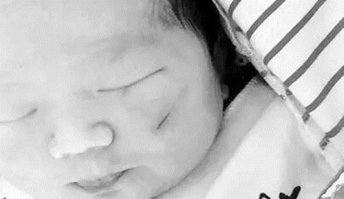 顺产|宝宝头部被剖腹产划伤,凭啥不算“事故”院方的回应很有道理