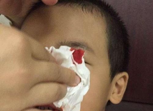 宝妈|4岁男孩鼻血不止,送医院被告知“无法抢救”,只因宝妈这一举动