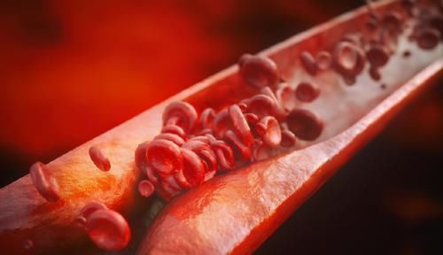 每天一片阿司匹林,坚持20年,78岁身体硬朗!