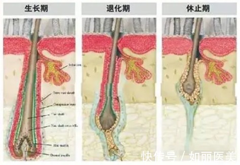 植发 植发后多久开始生长 休止期到生长期三个月完美蜕变