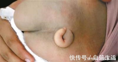 小尾巴|新生宝宝竟然长了条小尾巴, 原来是妈妈怀孕时少吃了这个!