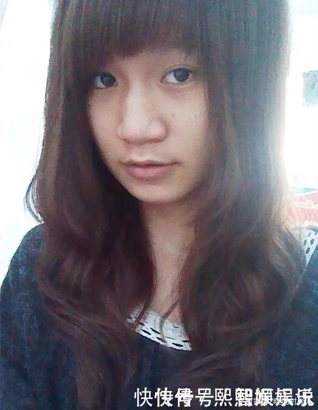 蒜头鼻|五种公认的“丑鼻型”，蒜头鼻、驼峰鼻都上榜了，第一个最常见