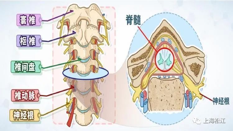 颈椎病患者|肩痛、手麻，是颈椎病？不一定！来看解答→