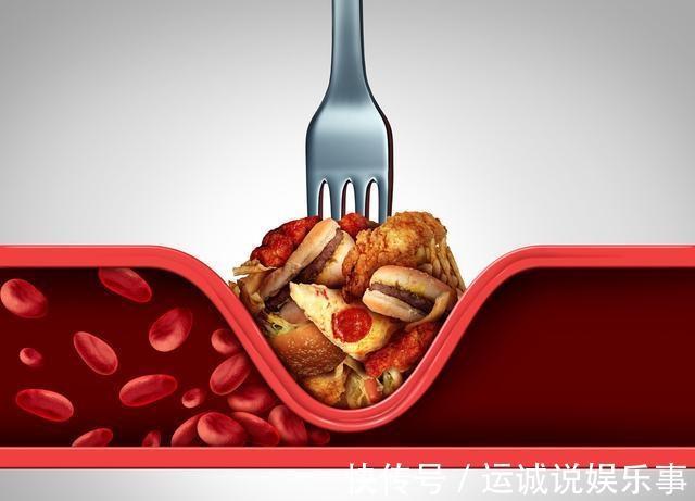 医生|70%的人血脂异常,医生:高血脂可以吃回去,这3个方法快告诉家人