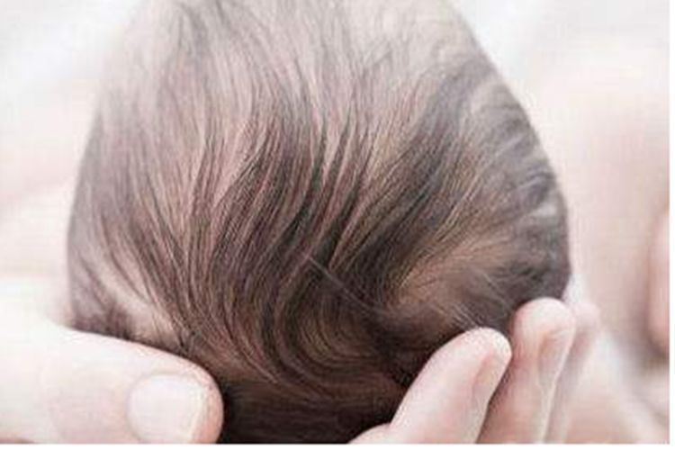 头型|这种“头型”的孩子,自身携带“高个”基因,中了的父母偷着乐吧