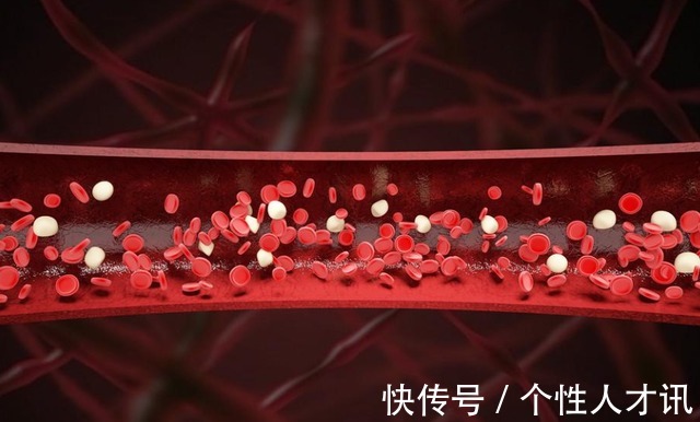 营养物质|26岁年轻女子血糖从12降到4.7，医生：3种食物常吃，或能保护胰岛