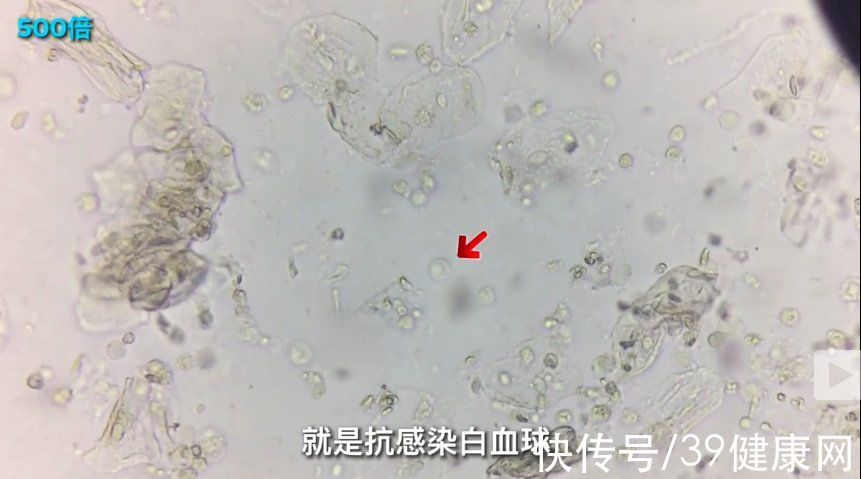 接吻病|情侣接吻时，为什么不觉得对方的口水恶心？原来身体有这些变化