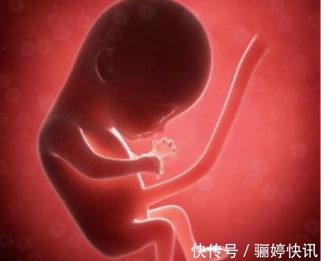 孕期|女性在孕期做这个动作,就会造成胎儿脐带绕颈,是真的吗