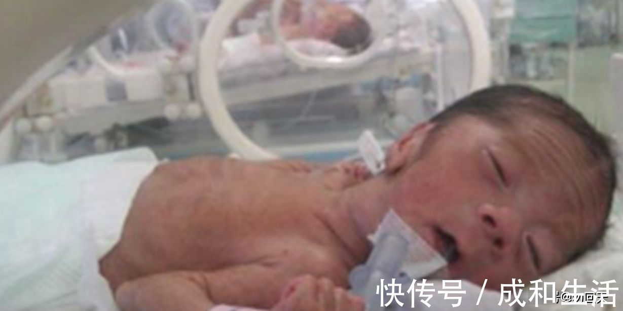 孕妇|怀孕时孕妇要注意 ,此类食物还是要少碰,别太大意