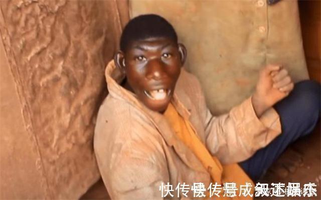 男子|非洲一男子长相似猴子,不吃饭只吃香蕉,常被人当动物欺负