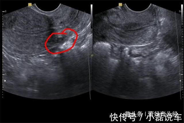 侥幸心理|女子怀孕7个月，胎儿突然停止胎动？“嘴馋”或成罪魁祸首