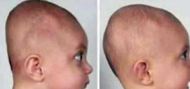 睡眠时间|“脑勺高,聪明包”,宝宝的头型与智商有关?父母们别再被误导了