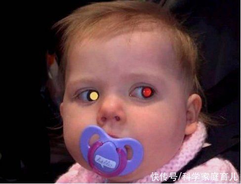 近距离|5岁娃近视1000度!罪魁祸首,不是手机,是「远视储备」