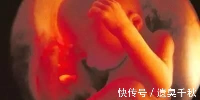 皱缩状|一组图记录怀胎十月,胎儿发育全过程,看完后,感叹生命神奇